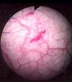 file/ELEMENTO_NEWSLETTER/11044/Malattie_rare.gif