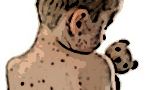file/ELEMENTO_NEWSLETTER/13476/Morbillo.gif