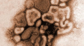 file/ELEMENTO_NEWSLETTER/14057/VirusH1N1.gif